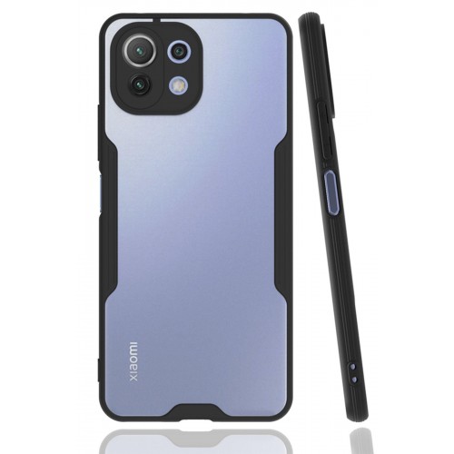 Newface Xiaomi Mİ 11 Lite Kılıf Platin Silikon - Siyah