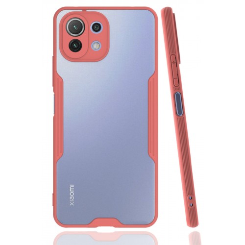 Newface Xiaomi Mİ 11 Lite Kılıf Platin Silikon - Pembe