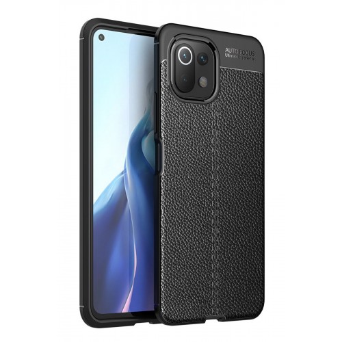 Newface Xiaomi Mİ 11 Lite Kılıf Focus Derili Silikon - Siyah